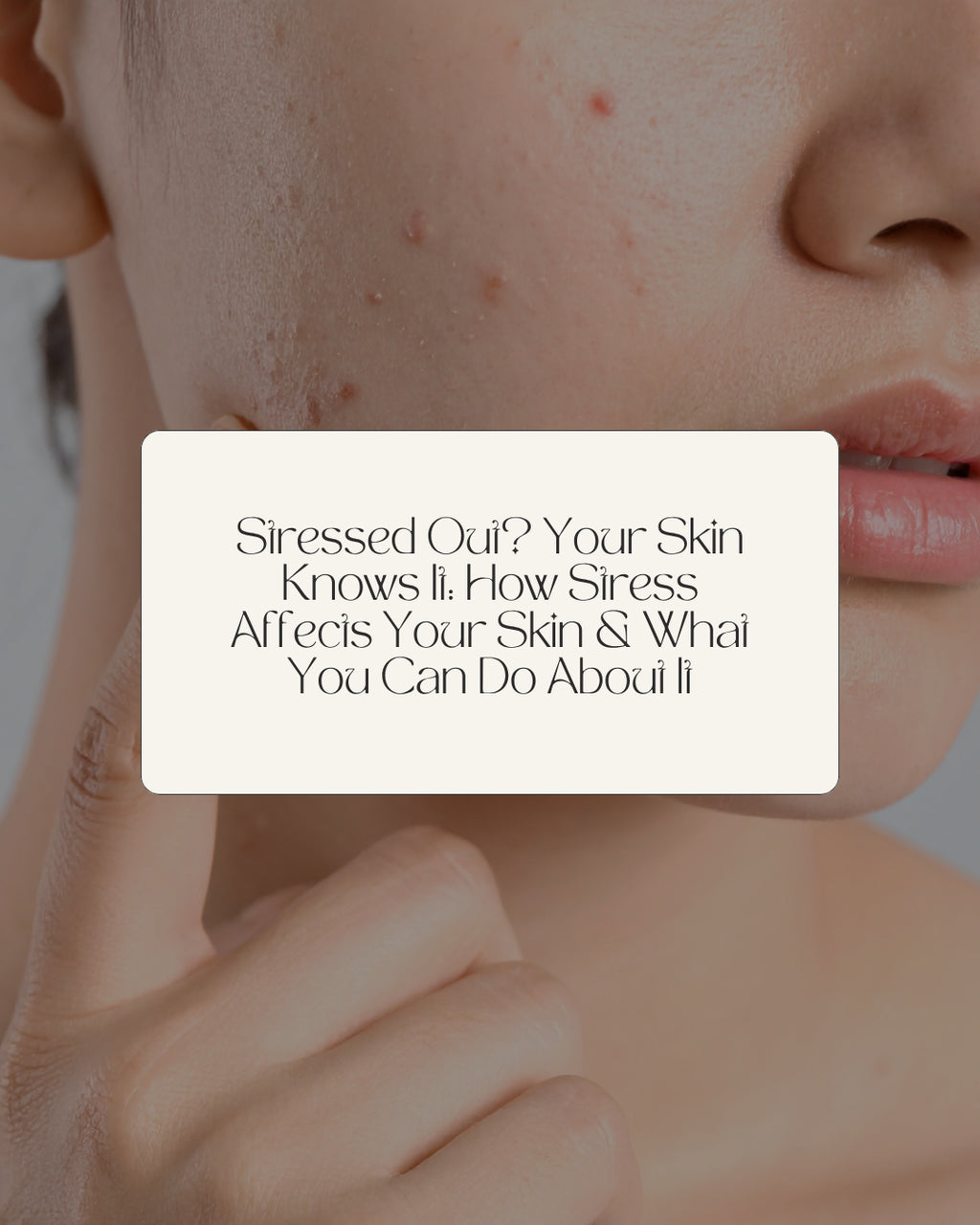 Stressed Out? Your Skin Knows It: How Stress Affects Your Skin & What You Can Do About It
