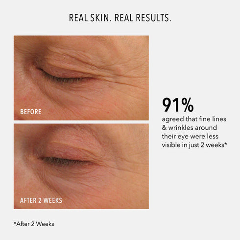 HYDROPEPTIDE EYE AUTHORITY