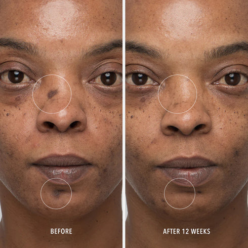 HYDROPEPTIDE INNERDERM RX