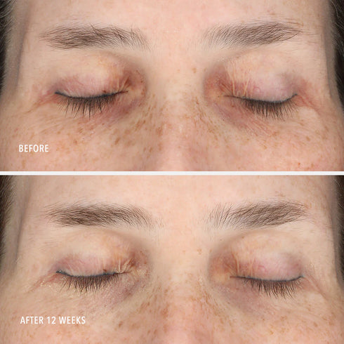 HYDROPEPTIDE INNERDERM RX