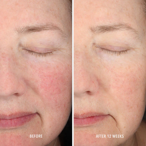 HYDROPEPTIDE INNERDERM RX