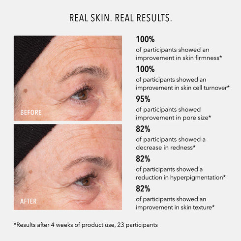 HYDROPEPTIDE LIQUID RESURFACING SOLUTION