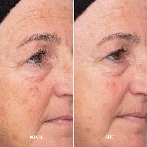 HYDROPEPTIDE LIQUID RESURFACING SOLUTION