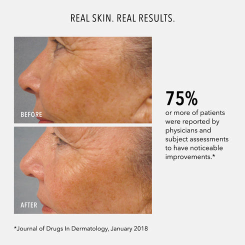 HYDROPEPTIDE LUMAPRO-C