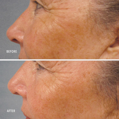 HYDROPEPTIDE LUMAPRO-C