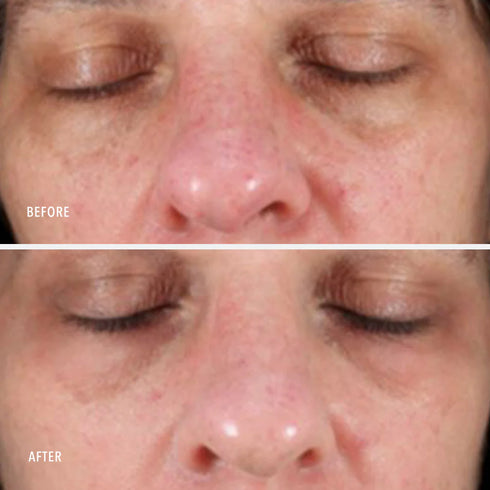 HYDROPEPTIDE NIMNI CREAM