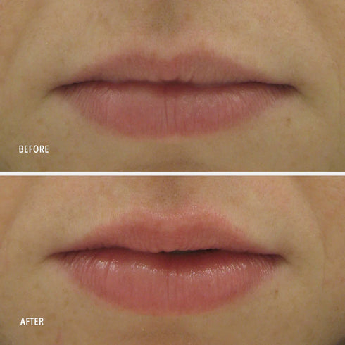 HYDROPEPTIDE PERFECTING GLOSS - SANTORINI