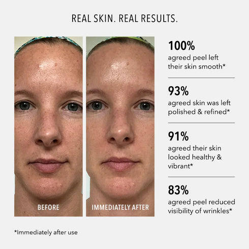 HYDROPEPTIDE POLISH & PLUMP PEEL