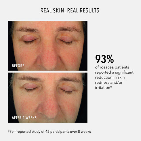 HYDROPEPTIDE SOOTHING SERUM