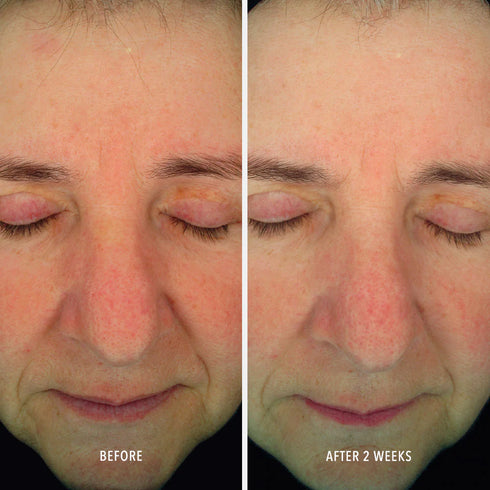 HYDROPEPTIDE SOOTHING SERUM